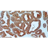 Immunohistochemistry - Anti-PAP Antibody [PASE/4LJ] (A320629) - Antibodies.com