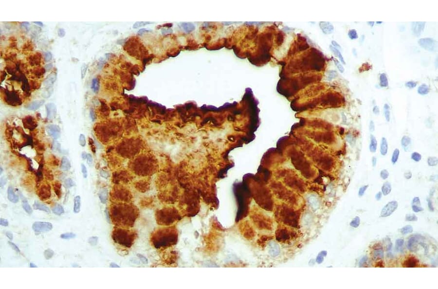 Immunohistochemistry - Anti-CA19-9 Antibody [C241:5:1:4] (A320630) - Antibodies.com