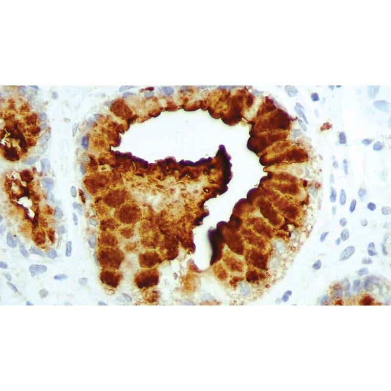 Immunohistochemistry - Anti-CA19-9 Antibody [C241:5:1:4] (A320630) - Antibodies.com