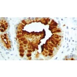 Immunohistochemistry - Anti-CA19-9 Antibody [C241:5:1:4] (A320630) - Antibodies.com