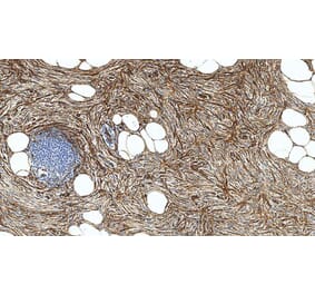 Immunohistochemistry - Anti-CD34 Antibody [QBEnd/10] (A320633) - Antibodies.com