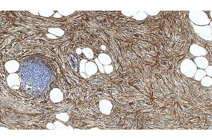 Immunohistochemistry - Anti-CD34 Antibody [QBEnd/10] (A320633) - Antibodies.com
