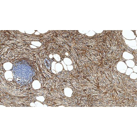 Immunohistochemistry - Anti-CD34 Antibody [QBEnd/10] (A320633) - Antibodies.com