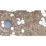 Immunohistochemistry - Anti-CD34 Antibody [QBEnd/10] (A320633) - Antibodies.com