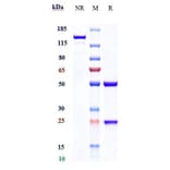 SDS-PAGE - Abagovomab Biosimilar - Anti-MUC16 Antibody - Low endotoxin, Azide free (A323261) - Antibodies.com