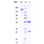 SDS-PAGE - Abelacimab Biosimilar - Anti-Factor XI Antibody - Low endotoxin, Azide free (A323262) - Antibodies.com