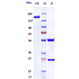 SDS-PAGE - Abituzumab Biosimilar - Anti-Integrin alpha V Antibody - Low endotoxin, Azide free (A323263) - Antibodies.com