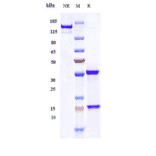 SDS-PAGE - Adecatumumab Biosimilar - Anti-EpCAM Antibody - Low endotoxin, Azide free (A323269) - Antibodies.com