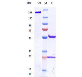 SDS-PAGE - Alacizumab Biosimilar - Anti-VEGF Receptor 2 Antibody - Low endotoxin, Azide free (A323271) - Antibodies.com