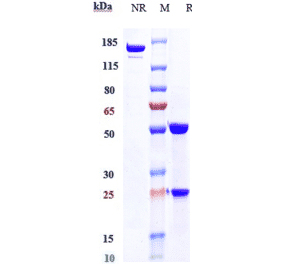 SDS-PAGE - Alemtuzumab Biosimilar - Anti-CD52 Antibody - Low endotoxin, Azide free (A323272) - Antibodies.com