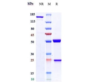 SDS-PAGE - Amivantamab Biosimilar - Anti-Met (c-Met) Antibody - Low endotoxin, Azide free (A323277) - Antibodies.com