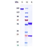 SDS-PAGE - Andecaliximab Biosimilar - Anti-MMP9 Antibody - Low endotoxin, Azide free (A323279) - Antibodies.com