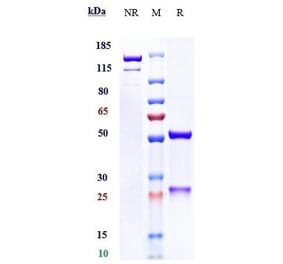 SDS-PAGE - Anetumab Biosimilar - Anti-Mesothelin Antibody - Low endotoxin, Azide free (A323282) - Antibodies.com