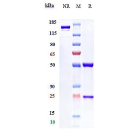 SDS-PAGE - Anifrolumab Biosimilar - Anti-Interferon alpha/beta Receptor 1 Antibody - Low endotoxin, Azide free (A323283) - Antibodies.com