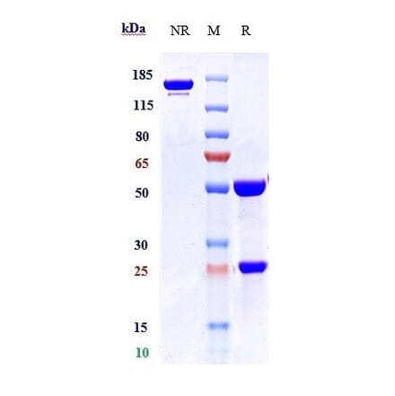 SDS-PAGE - Apamistamab Biosimilar - Anti-CD45 Antibody - Low endotoxin, Azide free (A323285) - Antibodies.com