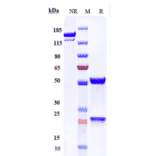 SDS-PAGE - Apitegromab Biosimilar - Anti-GDF8/Myostatin Antibody - Low endotoxin, Azide free (A323286) - Antibodies.com
