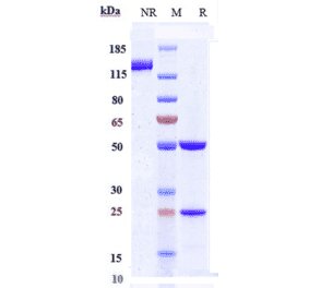 SDS-PAGE - Ascrinvacumab Biosimilar - Anti-ALK-1 Antibody - Low endotoxin, Azide free (A323288) - Antibodies.com