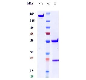 SDS-PAGE - Astegolimab Biosimilar - Anti-ST2 Antibody - Low endotoxin, Azide free (A323289) - Antibodies.com