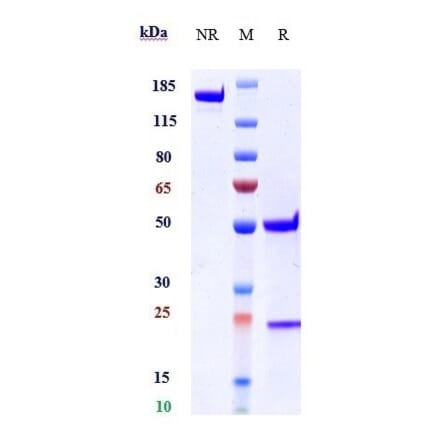 SDS-PAGE - Astegolimab Biosimilar - Anti-ST2 Antibody - Low endotoxin, Azide free (A323289) - Antibodies.com
