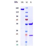 SDS-PAGE - Astegolimab Biosimilar - Anti-ST2 Antibody - Low endotoxin, Azide free (A323289) - Antibodies.com