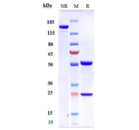 SDS-PAGE - Atezolizumab Biosimilar - Anti-PD-L1 Antibody - Low endotoxin, Azide free (A323290) - Antibodies.com
