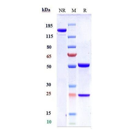 SDS-PAGE - Atezolizumab Biosimilar - Anti-PD-L1 Antibody - Low endotoxin, Azide free (A323290) - Antibodies.com