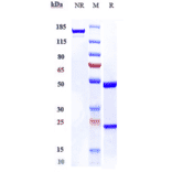 SDS-PAGE - Atinumab Biosimilar - Anti-Nogo Antibody - Low endotoxin, Azide free (A323292) - Antibodies.com