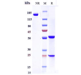 SDS-PAGE - Avdoralimab Biosimilar - Anti-C5a-R Antibody - Low endotoxin, Azide free (A323293) - Antibodies.com