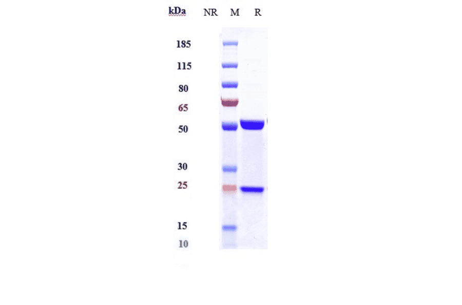 SDS-PAGE - Avizakimab Biosimilar - Anti-IL-21 Antibody - Low endotoxin, Azide free (A323295) - Antibodies.com