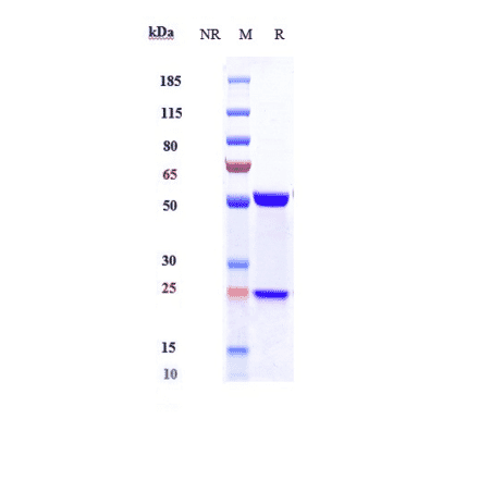 SDS-PAGE - Avizakimab Biosimilar - Anti-IL-21 Antibody - Low endotoxin, Azide free (A323295) - Antibodies.com