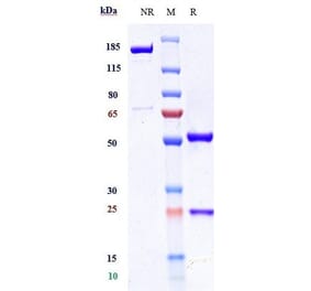 SDS-PAGE - Axatilimab Biosimilar - Anti-CSF-1-R Antibody - Low endotoxin, Azide free (A323296) - Antibodies.com