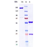 SDS-PAGE - Axatilimab Biosimilar - Anti-CSF-1-R Antibody - Low endotoxin, Azide free (A323296) - Antibodies.com