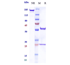 SDS-PAGE - Balstilimab Biosimilar - Anti-PD1 Antibody - Low endotoxin, Azide free (A323298) - Antibodies.com