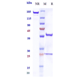 SDS-PAGE - Balstilimab Biosimilar - Anti-PD1 Antibody - Low endotoxin, Azide free (A323298) - Antibodies.com