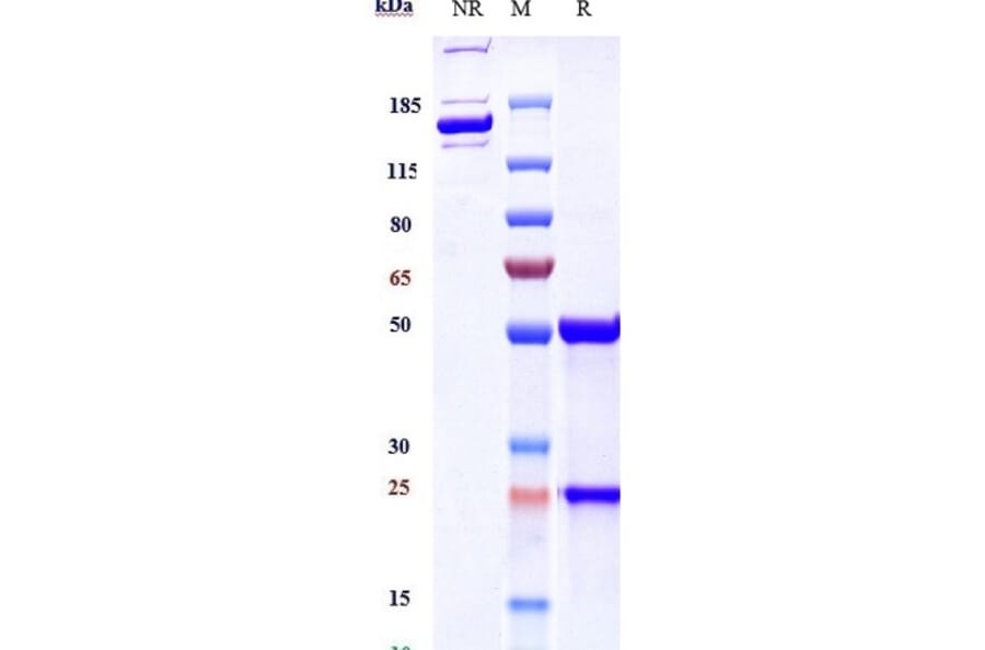 SDS-PAGE - Basiliximab Biosimilar - Anti-IL-2 Receptor alpha Antibody - Low endotoxin, Azide free (A323302) - Antibodies.com