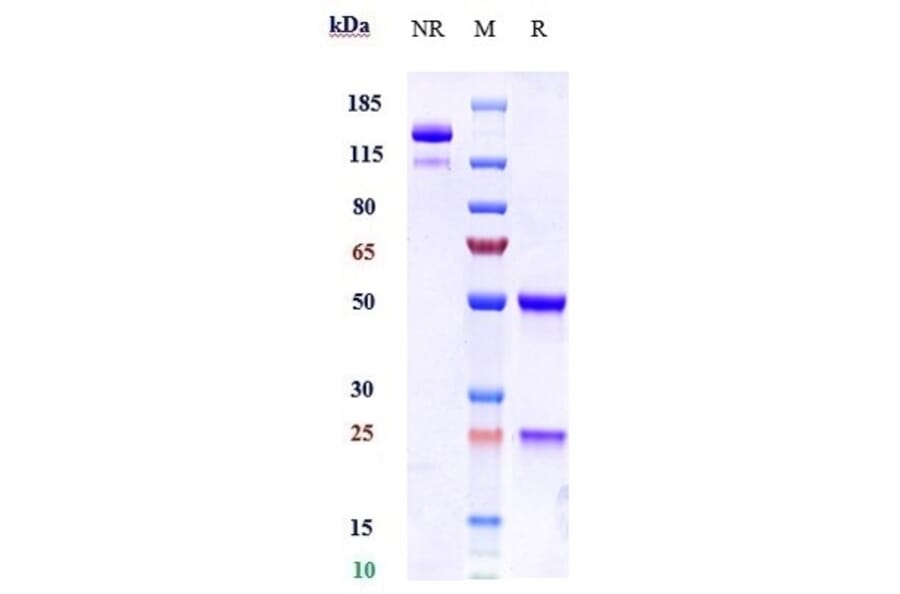 SDS-PAGE - Batoclimab Biosimilar - Anti-FCGRT/FCRN Antibody - Low endotoxin, Azide free (A323303) - Antibodies.com