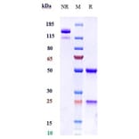 SDS-PAGE - Batoclimab Biosimilar - Anti-FCGRT/FCRN Antibody - Low endotoxin, Azide free (A323303) - Antibodies.com