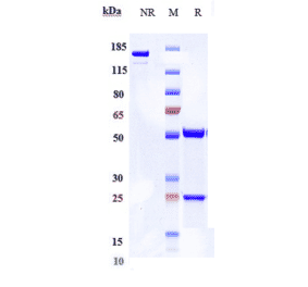 SDS-PAGE - Begelomab Biosimilar - Anti-DPP4 Antibody - Low endotoxin, Azide free (A323306) - Antibodies.com