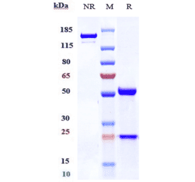 SDS-PAGE - Belantamab Biosimilar - Anti-BCMA Antibody - Low endotoxin, Azide free (A323308) - Antibodies.com