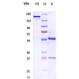 SDS-PAGE - Bemarituzumab Biosimilar - Anti-FGFR2 Antibody - Low endotoxin, Azide free (A323310) - Antibodies.com