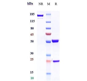 SDS-PAGE - Benralizumab Biosimilar - Anti-IL-5RA Antibody - Low endotoxin, Azide free (A323311) - Antibodies.com