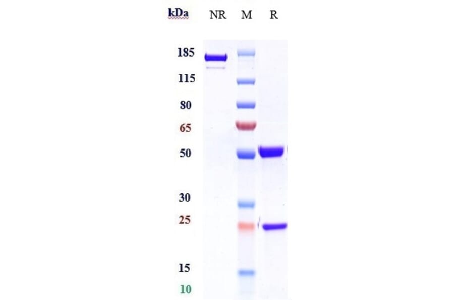 SDS-PAGE - Benralizumab Biosimilar - Anti-IL-5RA Antibody - Low endotoxin, Azide free (A323311) - Antibodies.com