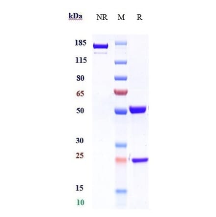 SDS-PAGE - Benralizumab Biosimilar - Anti-IL-5RA Antibody - Low endotoxin, Azide free (A323311) - Antibodies.com