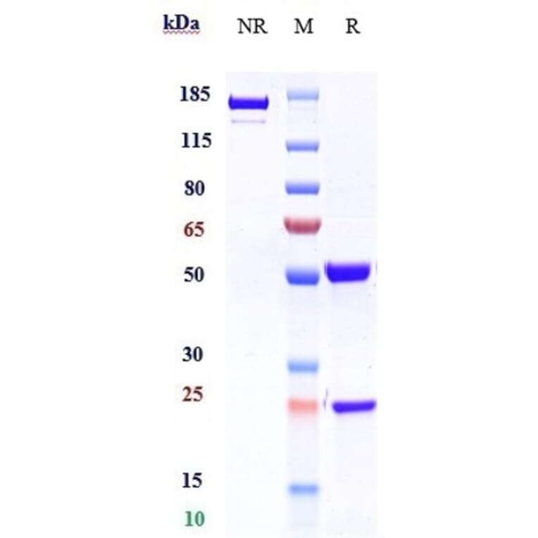 SDS-PAGE - Benralizumab Biosimilar - Anti-IL-5RA Antibody - Low endotoxin, Azide free (A323311) - Antibodies.com