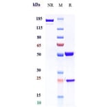 SDS-PAGE - Benralizumab Biosimilar - Anti-IL-5RA Antibody - Low endotoxin, Azide free (A323311) - Antibodies.com
