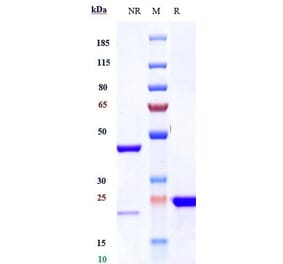SDS-PAGE - Anti-VEGFA Antibody [Research Grade Biosimilar] - Low endotoxin, Azide free (A323319) - Antibodies.com