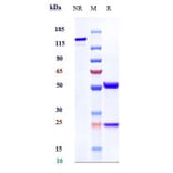 SDS-PAGE - Anti-VEGFA Antibody [Research Grade Biosimilar] - Low endotoxin, Azide free (A323321) - Antibodies.com