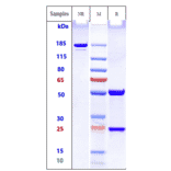 SDS-PAGE - Birtamimab Biosimilar - Anti-alpha Amyloid Antibody - Low endotoxin, Azide free (A323323) - Antibodies.com