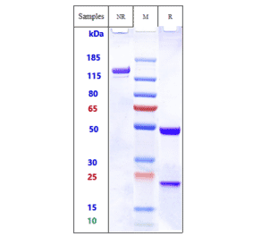SDS-PAGE - Bivatuzumab Biosimilar - Anti-CD44v6 Antibody - Low endotoxin, Azide free (A323324) - Antibodies.com