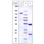 SDS-PAGE - Bivatuzumab Biosimilar - Anti-CD44v6 Antibody - Low endotoxin, Azide free (A323324) - Antibodies.com